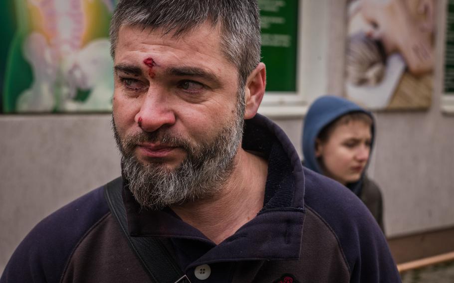 Serhii Kindra, 42, and his son Tymofii, 10, wait outside a hospital where his other son, Matvii, 13, lies in critical condition. The family was struck by cluster munitions by the Antonovsky Bridge near Antonivka, Ukraine, a suburb of Kherson. The area is being targeted by Russian forces after an earlier retreat.