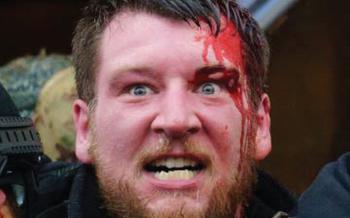 Kyle Fitzsimons outside the U.S. Capitol on Jan. 6, 2021, in Washington, D.C. Fitzsimons’s attorney, Natasha Taylor-Smith, a federal public defender from Philadelphia, said because this photo of a bloodied Fitzsimons was widely published, he “has become the poster child for January 6.” 