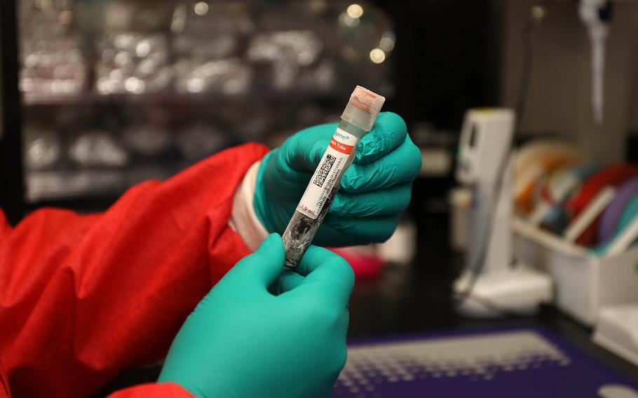 A laboratory technician prepares a blood sample 