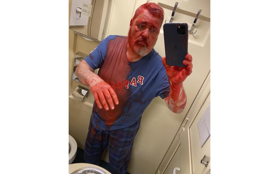 In this photo published on Novaya Gazeta Europe’s Telegram channel, Nobel Peace Prize-winning newspaper editor Dmitry Muratov takes a selfie after he said he was attacked on a Russian train by an assailant who poured red paint on him, causing his eyes to burn severely, Russia, Thursday, April 7, 2022. Muratov told Novaya Gazeta Europe, a project launched by newspaper staff after the paper suspended operation last week under government pressure, that the Thursday assault happened on a train heading from Moscow to Samara. 