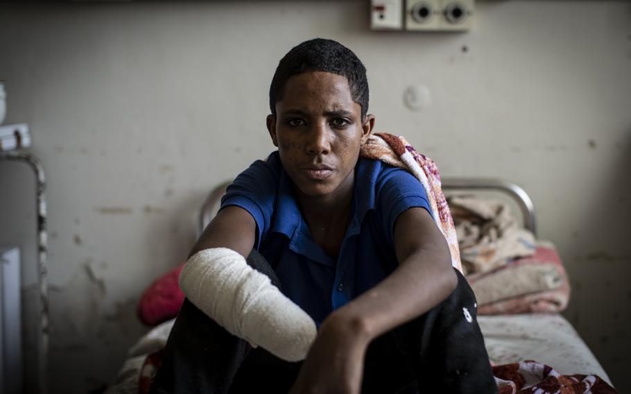 Haftom Gebretsadik, a 17-year-old from Freweini, Ethiopia, near Hawzen, who had his right hand amputated and lost fingers on his left after an artillery round struck his home in March, sits on his bed at the Ayder Referral Hospital in Mekele, in the Tigray region of northern Ethiopia, on Thursday, May 6, 2021.