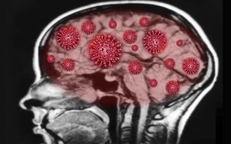 An illustration depicts a human brain affected by a coronavirus infection. 
