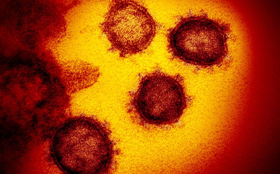 An image from an electron microscope shows SARS-CoV-2, the virus that causes COVID-19.  