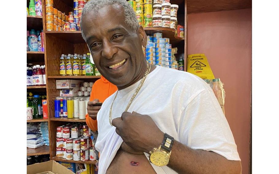 Tony Grier, 59, shows his gunshot wound after taking a stray bullet in Harlem on July 13, 2021.