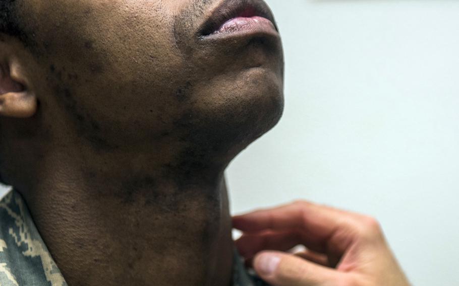 A flight surgeon inspects an airman’s neck and face during a shaving waiver course at Beale Air Force Base, Calif., March 15, 2018. 