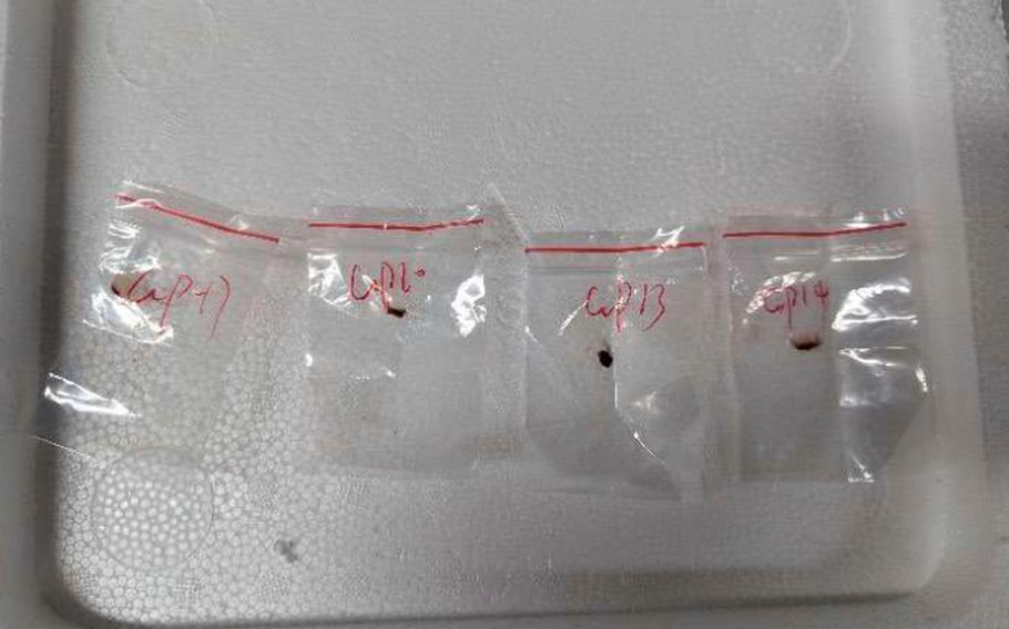 Toxic pathogens in plastic.