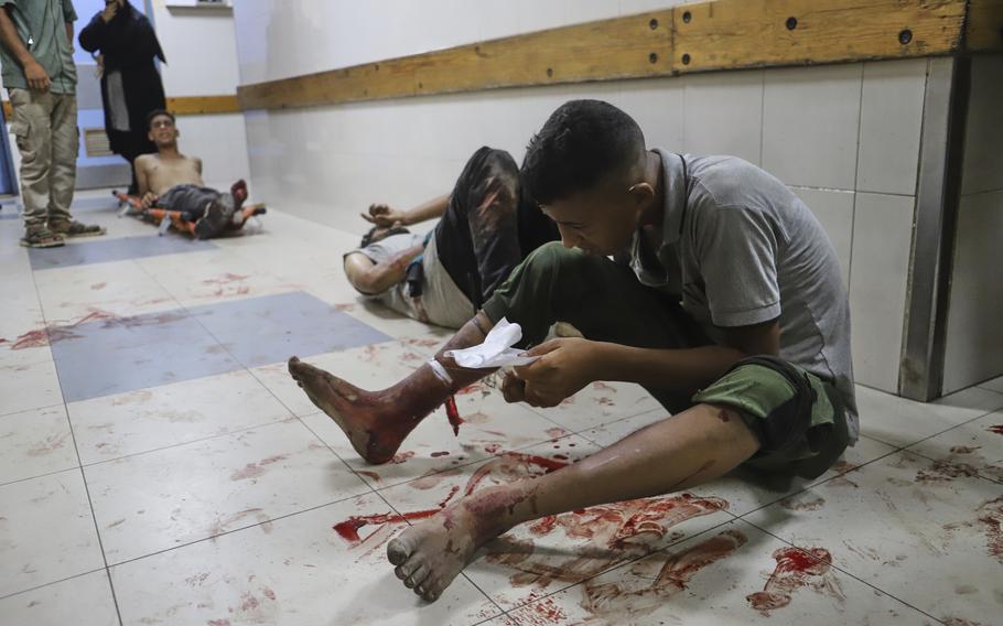 A Palestinian man injured wrapping his leg.