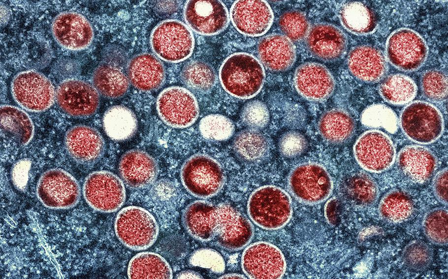 This colorized electron microscope image provided by the National Institute of Allergy and Infectious Diseases shows mpox particles, red, found within an infected cell, blue, cultured in a laboratory in Fort Detrick, Md. A study released by the U.S. Centers for Disease Control and Prevention on Thursday, May 25, 2023, suggests dozens of U.S. cities are at risk for mpox outbreaks this summer. 