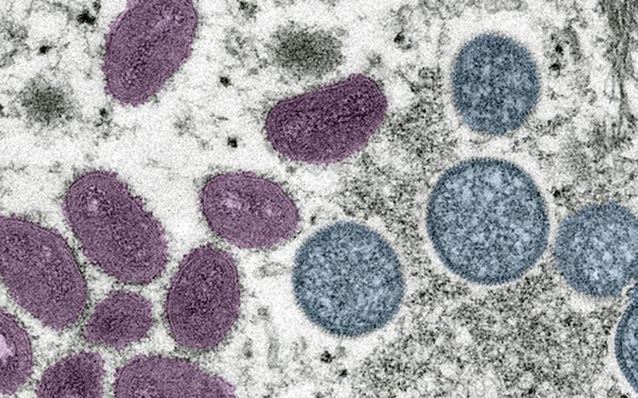 An image of the monkeypox virus. The Biden administration signed an $11 million deal to support a Michigan company that’s helping make vaccine against monkeypox, another move to bolster prevention of the quickly spreading virus.