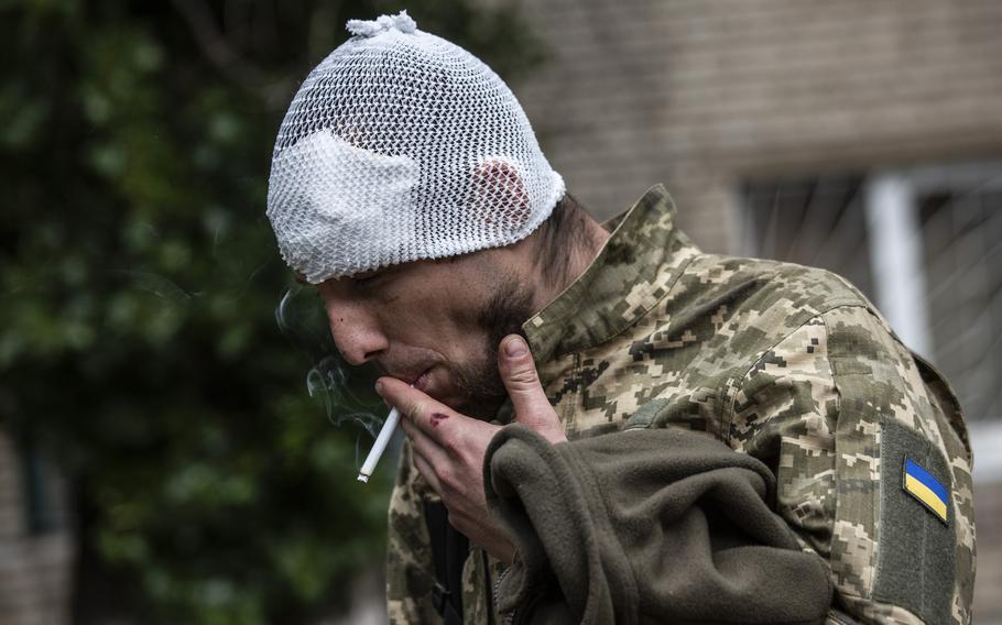 Koleh, 25, a wounded Ukraine soldier, smokes a cigarette as he arrives at a hospital in eastern Ukraine on May 29, 2022. 