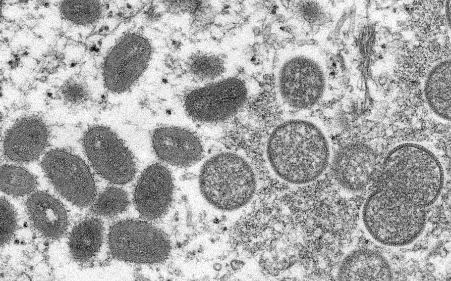 This 2003 electron microscope image shows mature, oval-shaped monkeypox virions, left, and spherical immature virions, right, obtained from a sample of human skin associated with the 2003 prairie dog outbreak. 