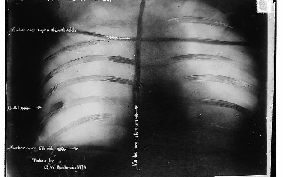 An x-ray image of Theodore Roosevelt’s chest showing the bullet lodged in his chest muscle. It remained there for the rest of his life. 