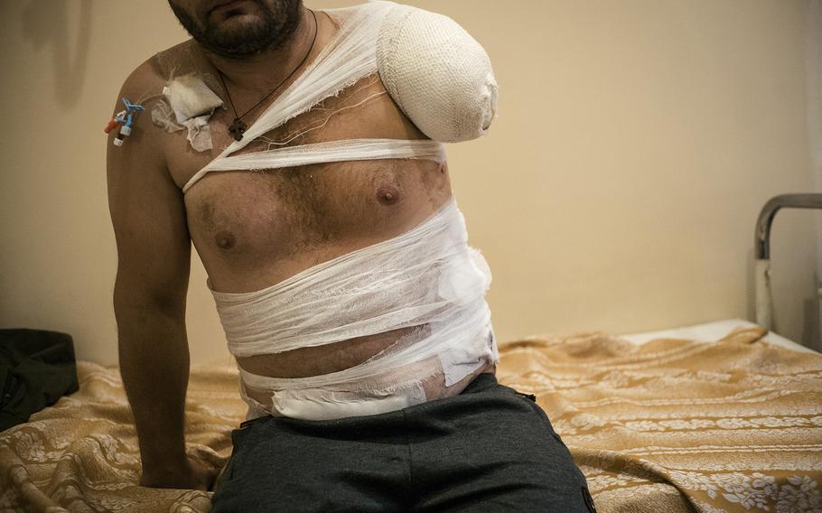 Oleksandr, a 28-year-old Ukrainian soldier, lost his arm while fighting Russian forces occupying Kherson, which is part of Russian President Vladimir Putin’s coveted “land bridge” to Crimea. 