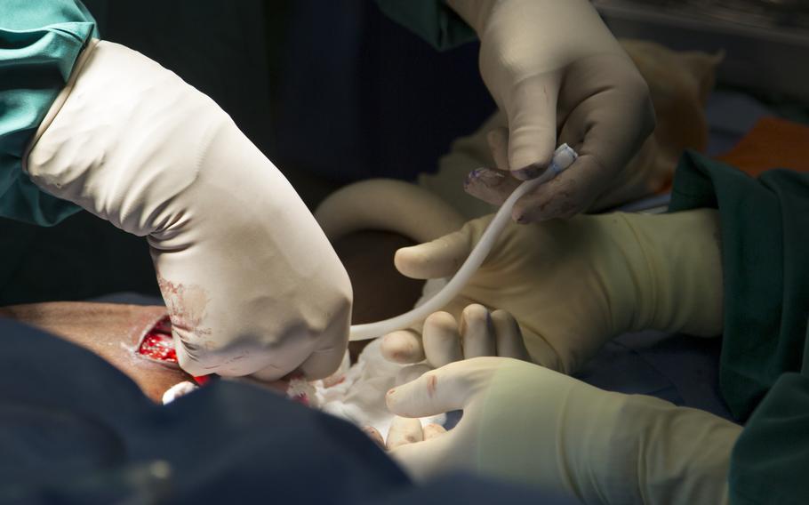 Surgeons handle a human acellular vessel during an operation. 