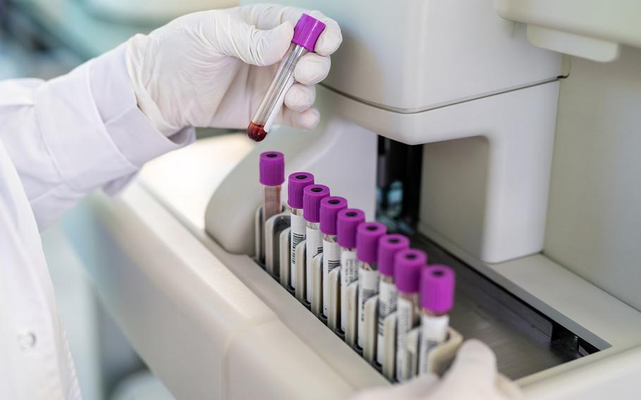 Gloved hands handle vials.