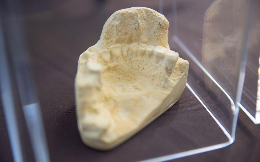 An impression of the teeth from one of the skeletal remains found at a Rowan University archaeological dig on display in National Park, N.J., on Tuesday, Aug. 2, 2022.