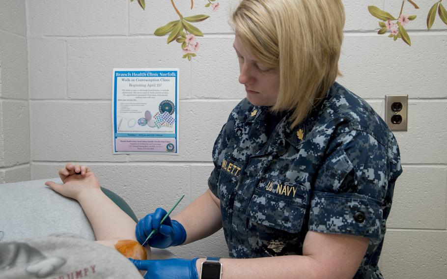 Navy Lt. Cmdr. Stacey Hamlett removes Nexplanon, a long-acting birth control implant, from a patient’s arm at a walk-in contraception clinic April 25, 2017, at Naval Station Norfolk, Va. The Navy began offering same-day, no-appointment-necessary contraception clinics in 2016 to increase access to counseling and prescriptions for sailors, a practice the Defense Health Agency is now considering expanding to all military treatment facilities. 