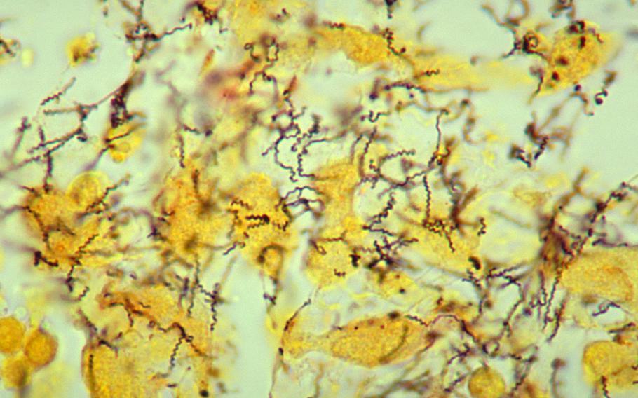 A photomicrograph shows the presence of Treponema pallidum spirochetes, the causative agent of syphilis, in a tissue sample taken from an infected rabbit.