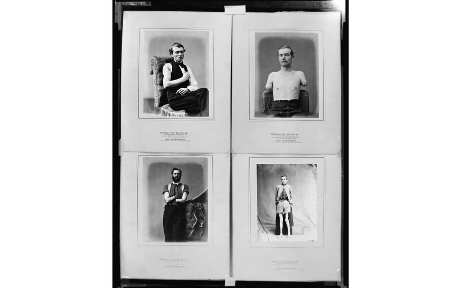 Photographs document Civil War veterans' wounds. Clockwise from top left: John Brink of Company K, 11th Pennsylvania Cavalry; Sgt. Warden; Allison Shutter, Company C, 7th Pennsylvania Reserves; Samuel H. Decker, Company I, 9th U.S. Artillery. 