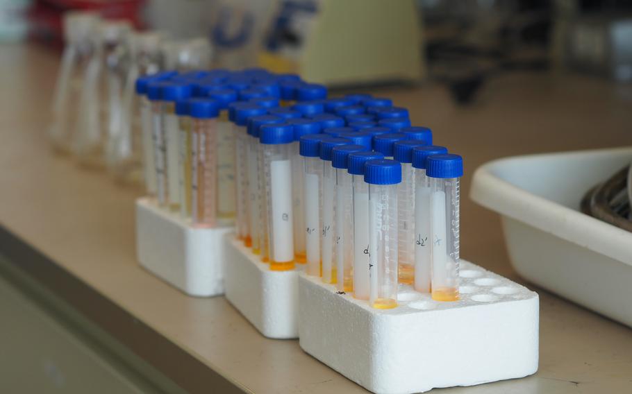 Water samples containing different concentrations of pollutants. 