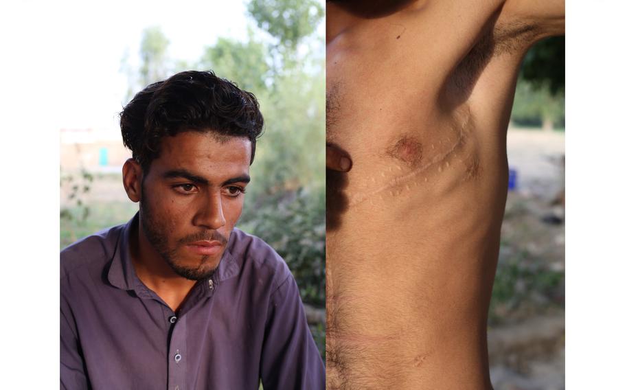 Spin Ghar says he was shot three times when he was 12 by 02 soldiers outside their base in Jalalabad.