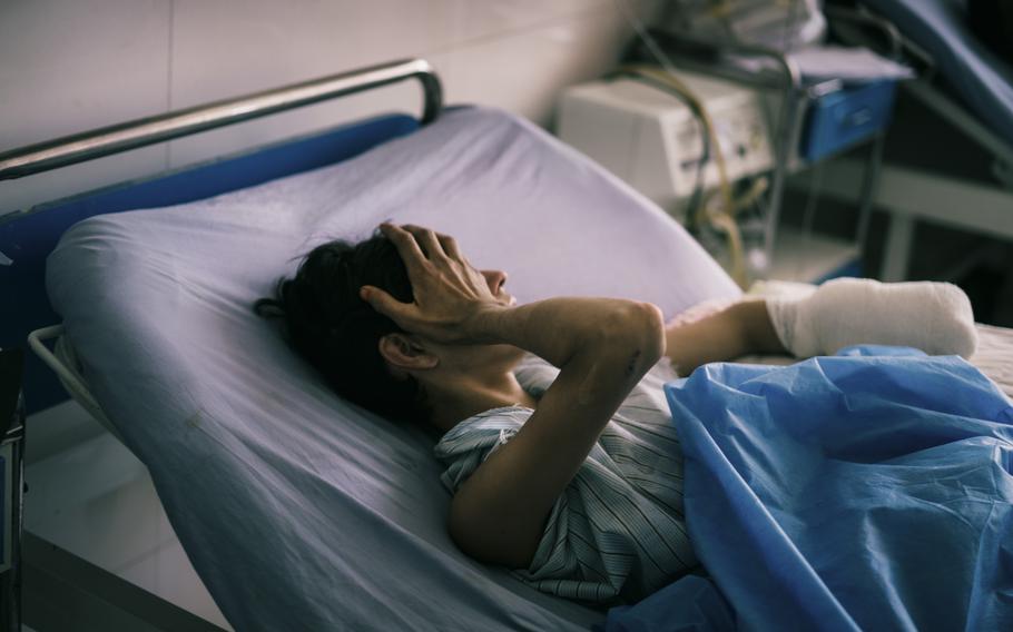 As the Taliban have moved closer to Kunduz city, more civilians are being injured. Abdulrahman, 14, lost his left hand earlier this month while gathering wheat when a mortar from a nearby Afghan army base landed beside him. Photographed July 14, 2021. 