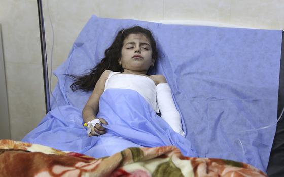 An Iraqi girl with burns in her hand lies on a bed in a hospital in Hamdaniya, Nineveh province, Iraq, as she was injured in a fire at a wedding hall Wednesday, Sept. 27, 2023.  A fire that raced through a hall hosting a Christian wedding in northern Iraq killed multiple and injured others, authorities said Wednesday.
