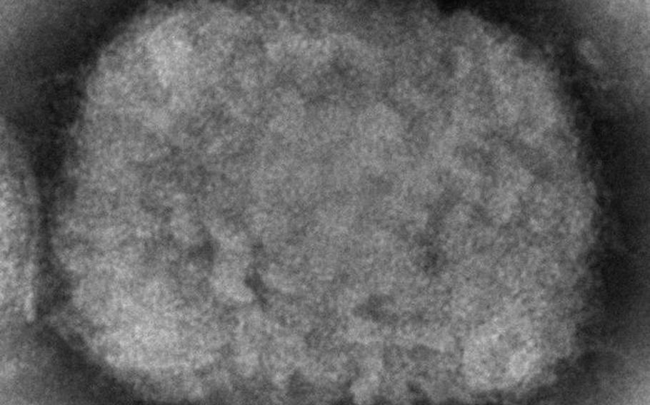 An electron microscope image of a monkeypox viron. A man who recently traveled to Canada was tested for the virus Tuesday, and the infection was confirmed by the CDC on Wednesday, the Massachusetts Department of Public Health said in a statement.