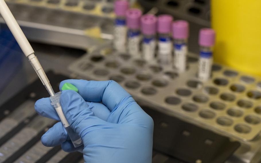 A medical laboratory technician inactivates suspected monkeypox samples to be PCR tested at the microbiology laboratory of La Paz Hospital on June 6, 2022 ,in Madrid, Spain. 