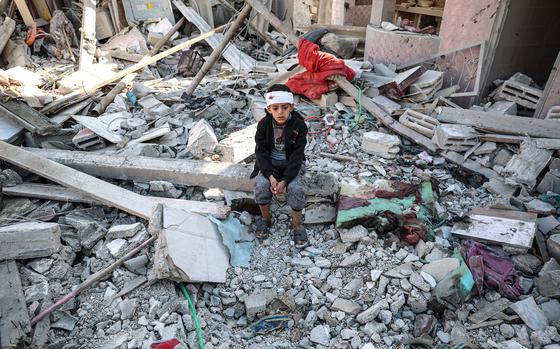 An injured child sits amid the rubble of a destroyed building in Rafah, southern Gaza, on Jan. 18, 2024.
