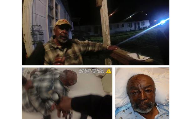 Top: A screen grab from a police body-camera video shows Carl Grant sitting on the porch of a stranger’s home in Birmingham, Ala., after police were called there on Feb. 2, 2020.  Bottom left: Grant lies on the floor at a hospital in Birmingham, Ala., on Feb. 3, 2020, as a police officer prepares to handcuff him. Bottom right: Grant is seen in a bed with wounds on his head at the UAB Hospital in Birmingham, Ala., on Feb. 2, 2020. Grant died nearly six months later. The death certificate worksheet lists his paralysis as the cause, attributing it to “physical assault with body slam.” 
