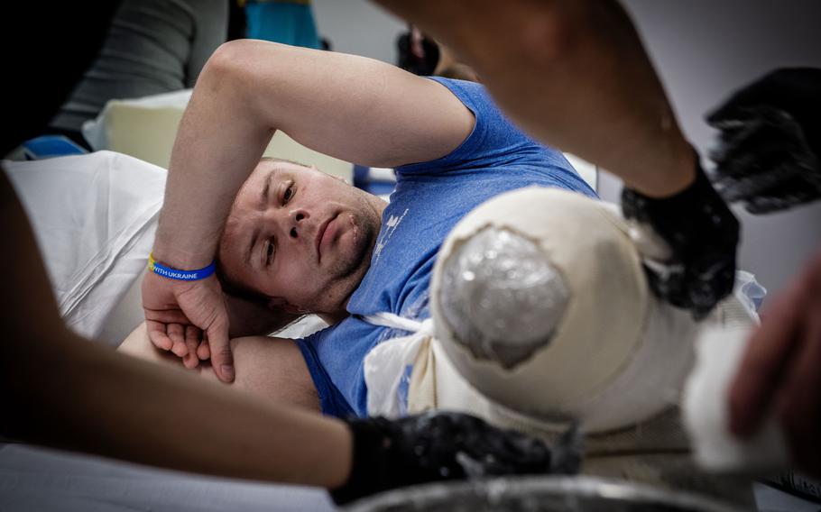 Oleksandr Fedun, one of the Ukrainian soldiers getting replacement limbs at Medical Center Orthotics and Prosthetics in Silver Spring, Md., watches as technicians prepare to make plaster casts of what remains of his legs. 