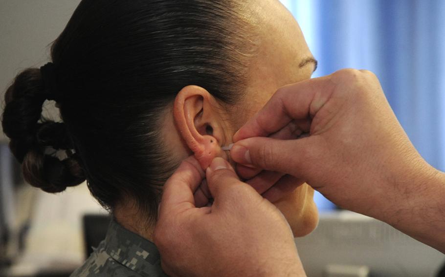 Dr. (Maj.) Ronald White, director of pain services at Landstuhl Regional Medical Center, applies an acupuncture needle on Master Sgt. Jamie Gilmore. Gilmore receives the treatment regularly for a bulging disk and other back pain.


