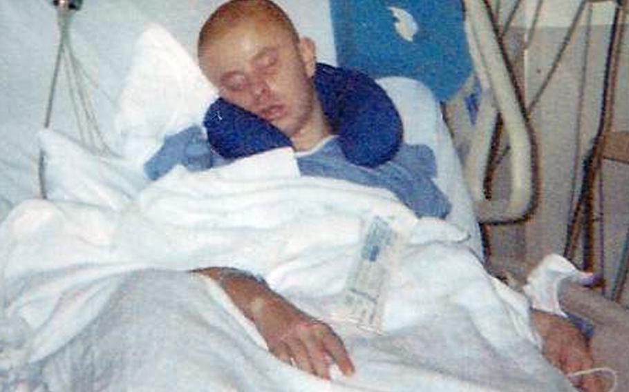 Erik Schei recovering in the hospital after he was shot in the head by an armor-piercing bullet in Iraq in 2005. Most of his skull was removed to allow the brain to swell.