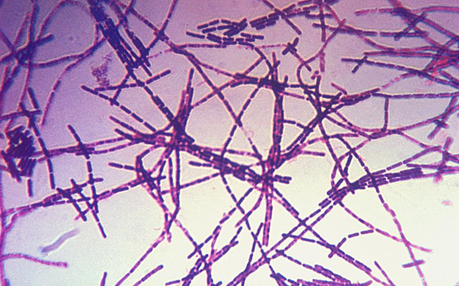 A photomicrograph of anthrax bacteria using Gram stain technique.
