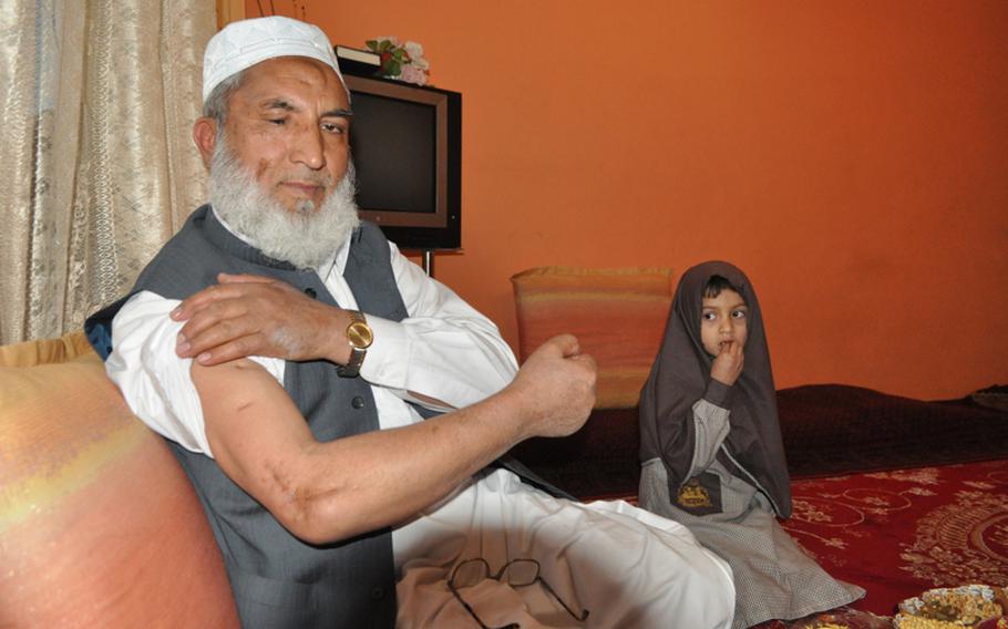 Ghullam Sarwar Jamili shows scars from his civil war wounds during an interview in his Kabul home on Nov. 13. Jamili was released from the U.S. detention facility in Bagram in September after 3.5 years.