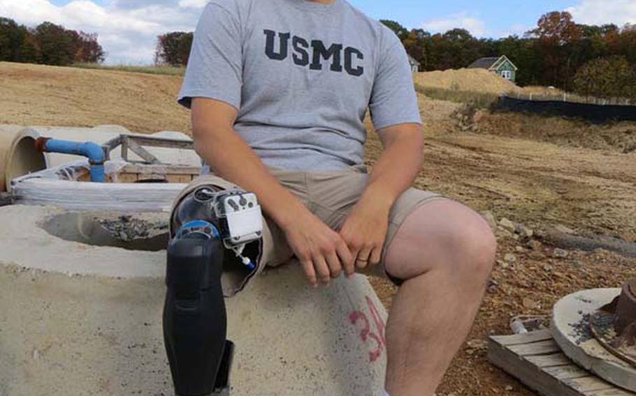 New developments in lower limb prosthetics that mimic the human body have dramatically improved the life of retired Marine William Gadsby, who was wounded by an IED and sniper's bullet in Iraq that ultimately claimed his right leg. Here, Gadsby wears his X2 microprocessor knee from Ottobock and BiOM ankle, developed by iWalk. When used together, Gadsby can walk with a natural gait like the uninjured, without pain and fatigue, and has resumed his active lifestyle. Gadsby can now hike mountain trails and walk naturally on sand dunes, something that has allowed for exercise and greatly improved his mental well-being.