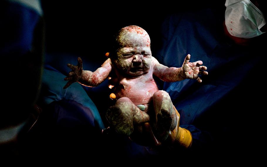 Christian Berthelot, "caesar #19" | Children born by incision.