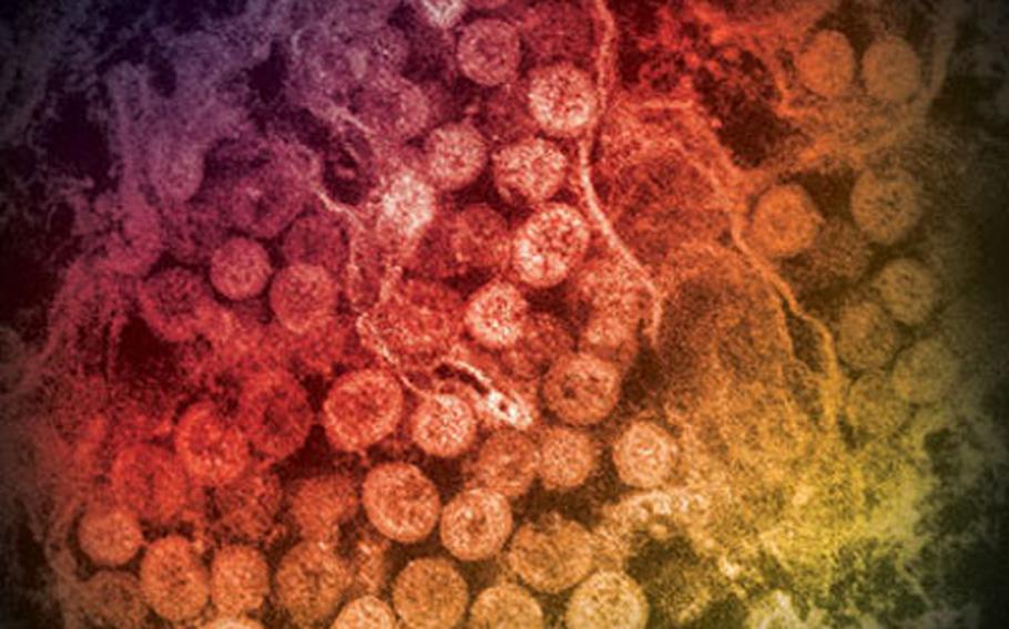 An electron micrograph shows a thin section of Middle East Respiratory Syndrome Coronavirus (MERS-CoV), showing the spherical particles within the cytoplasm of an infected cell.