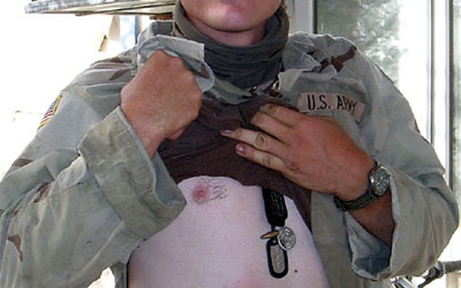 Sgt. Jason Glasscock, 27, of Shreveport, La., was struck a sniper’s bullet on June 15. At the time, Glasscock had opened the hatch of his tank and was reaching for an MRE. His body armor stopped the round but as Glasscock put it: “It felt like someone hit me with an iron pipe.”