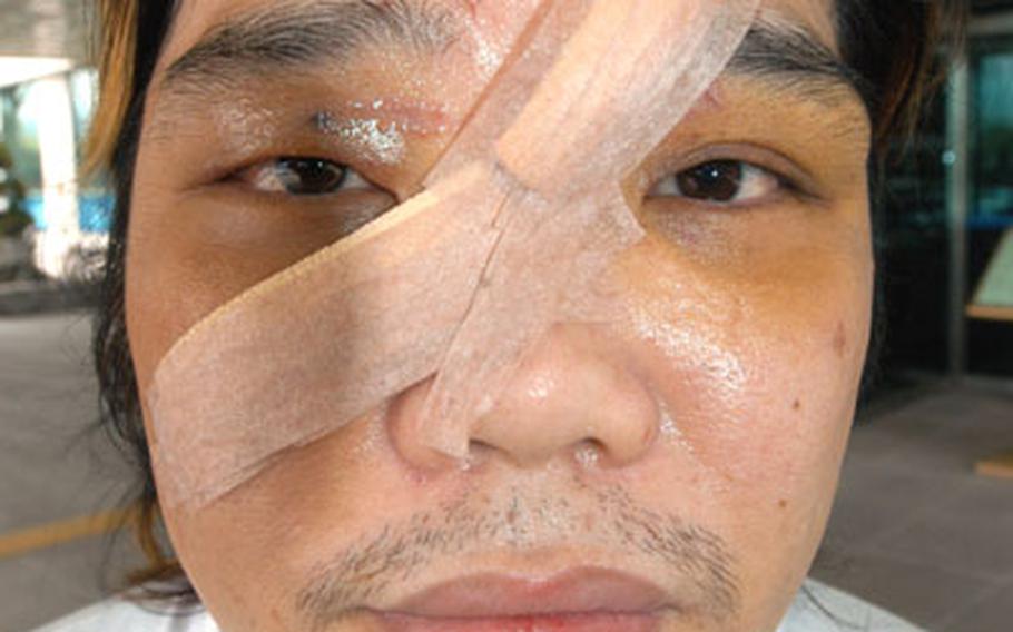 This photograph of Cho Su-Whan, 34, was taken shortly after he told police three U.S. soldiers had accosted him and one cut his face with a broken bottle.