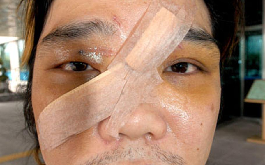 Cho Su-Whan, 34, required eight inches of stitches to close a gash after being hit with a bottle on July 2. A U.S. soldier has pleaded guilty in the attack.