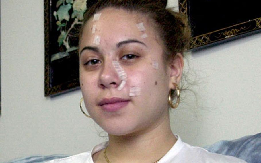 Jasmyn Chambers, 18, needed 80 stitches in her face after being attacked with a broken beer bottle outside a Seoul nightclub. Pfc. Christopher Myers is charged with aggravated assault in the incident.