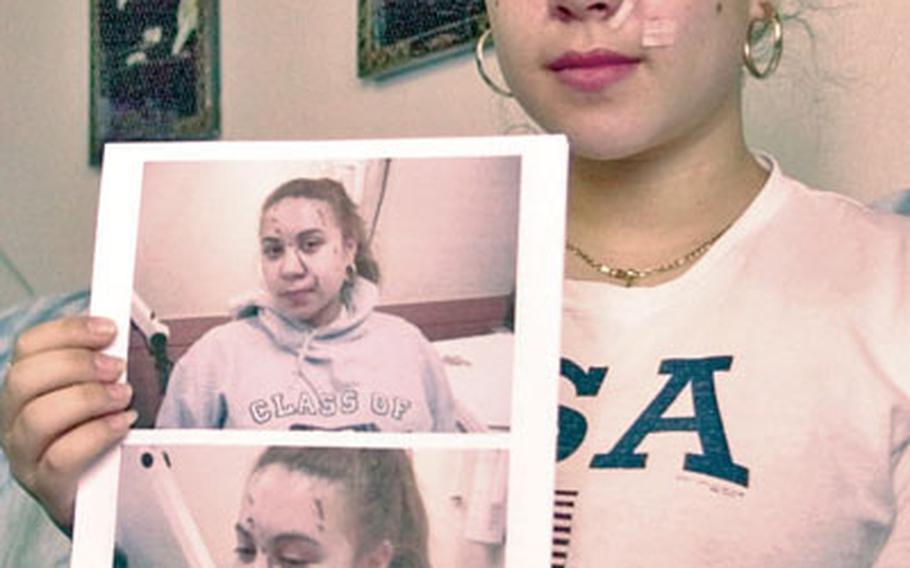 Jasmyn Chambers, 18, shows pictures from the hospital on Feb. 25, the day Pfc. Christoper Myers allegedly sliced her face with a broken beer bottle outside a Seoul nightclub. South Korean officials have decided not to prosecute Myers.