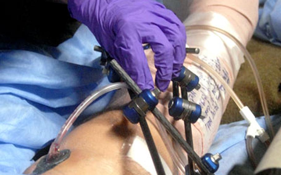 Air Force Maj. Bonnie Bosler, a flight nurse with the 514th Aeromedical Evacuation Squadron, tends to the leg wound of a Marine who was shot in Afghanistan. The wound is being treated with the V.A.C. Freedom, a portable wound vacuum system, as part of an ongoing Air Force study to determine the feasibility of using the devices on medevac flights between Germany and the States.