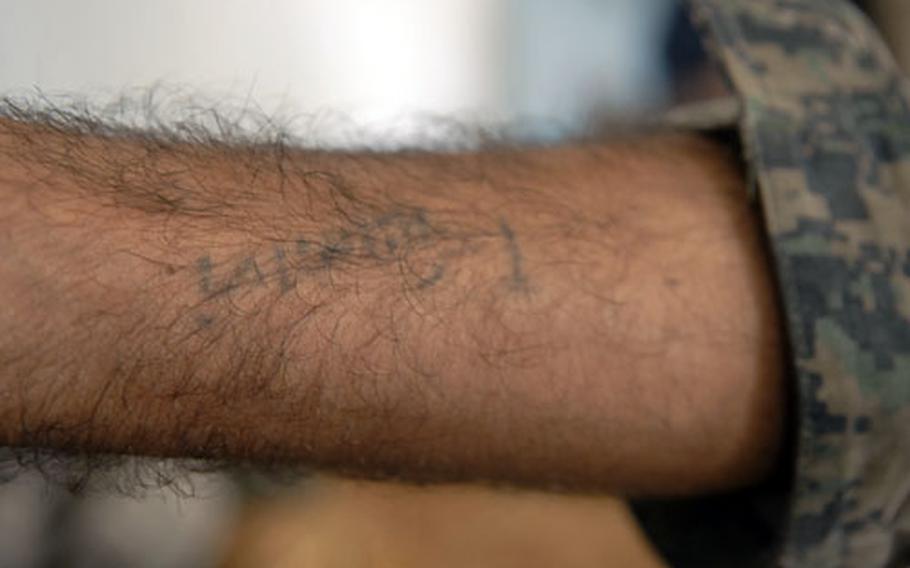 Iraqi Army Sgt. Ali Raheem shows off a faded tattoo he says he inked himself while serving in the army before the U.S. invasion. Because of army rules prohibiting tattoos, he is getting is removed through a painful surgical procedure.