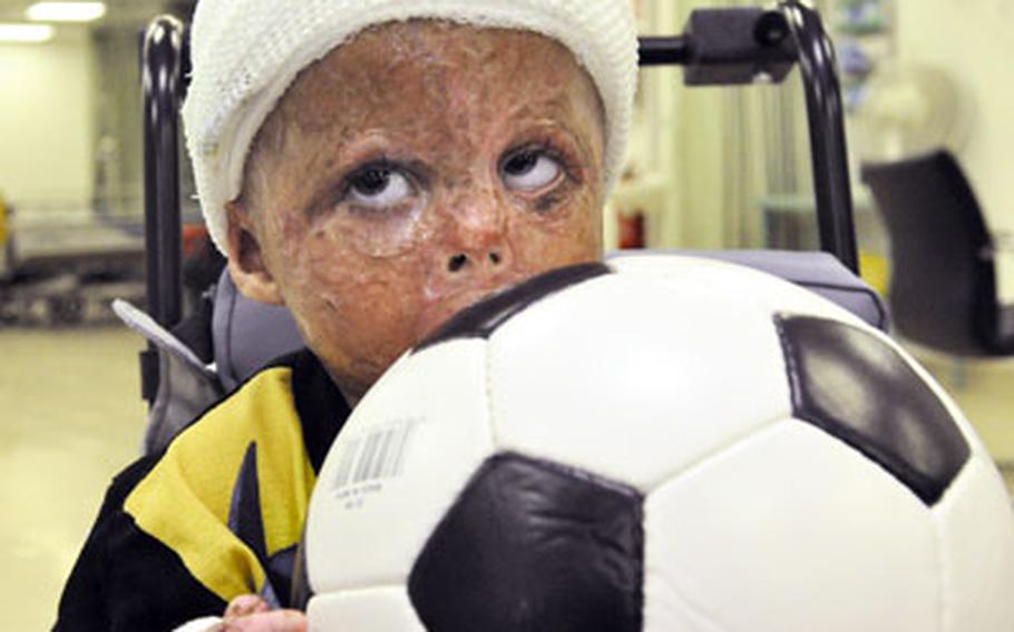 Tarik, 3, arrived at the Air Force Theater hospital nearly three months ago with severe burns to his legs, arms and face after stumbling into a fire. It’s not just the roadside bombs and stray bullets that make it dangerous to be a child in Iraq.