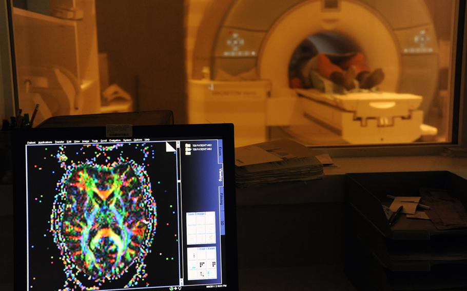 A servicemember receives a diffusion tensor imaging scan of his brain at Landstuhl Regional Medical Center in Germany. Diffusion tensor imaging, a variation of MRI, was used in a recent study that showed that servicemembers who were exposed to blasts and diagnosed with mild traumatic brain injuries were more likely to have abnormalities consistent with nerve damage in two or more brain regions, areas not typically associated with civilian concussions.