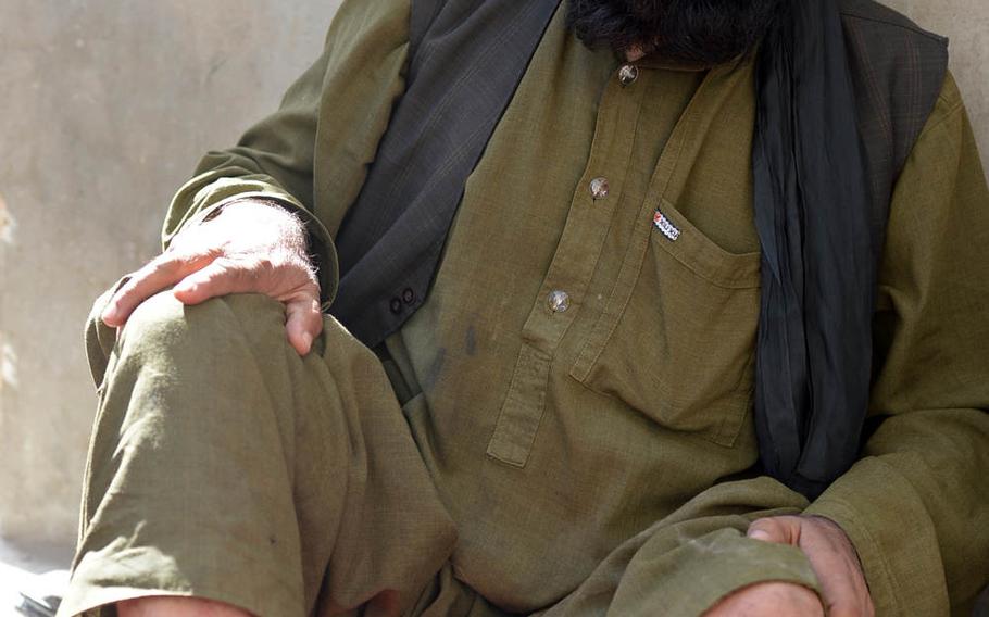 Gul Janan displays his leg, part of which he lost when he stepped on a mine left in his house by retreating militants during fighting with Afghan security forces in Helmand province. He is shown here on Tuesday, Sept. 23, 2014.