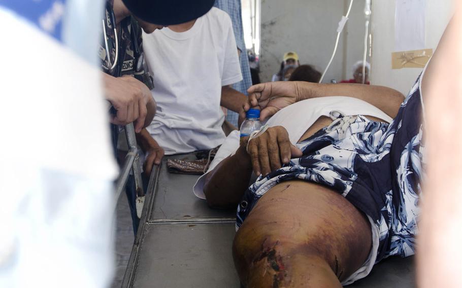 A team of Australian surgeons and American paramedics work to save the leg of a Filipino typhoon victim from amputation at Tacloban Airport November 16, 2013.